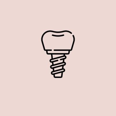 Implantes dentários